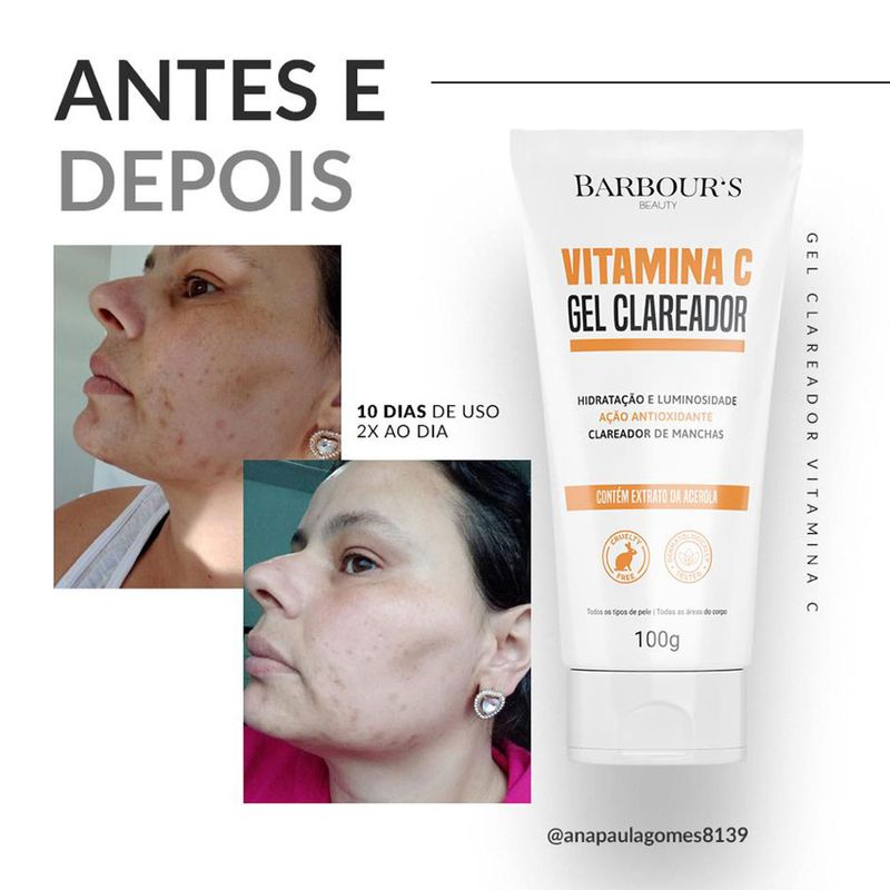 Gel Clareador Barbours Beauty Vitamina C 100ml em Oferta Farmadelivery